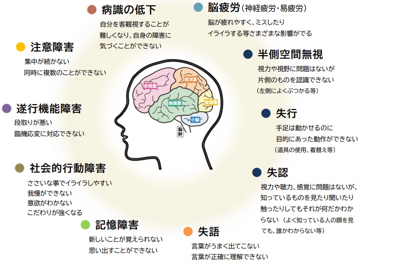 高次脳機能障害とは | 高次脳機能障害支援 | 千葉県千葉